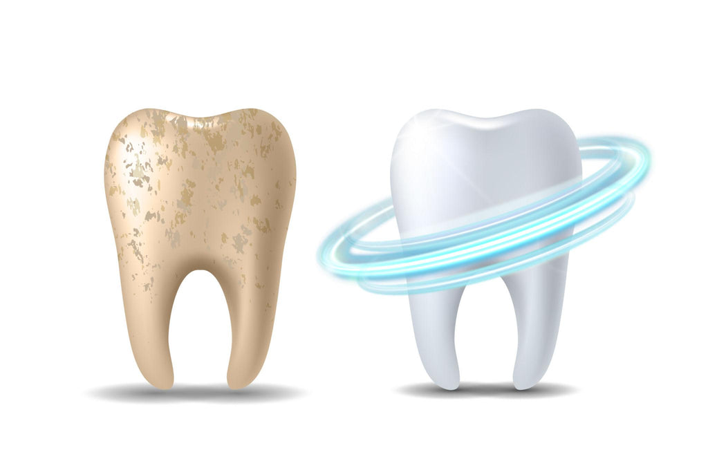 ELECTRIC TOOTHBRUSH (SELLING SETUP)